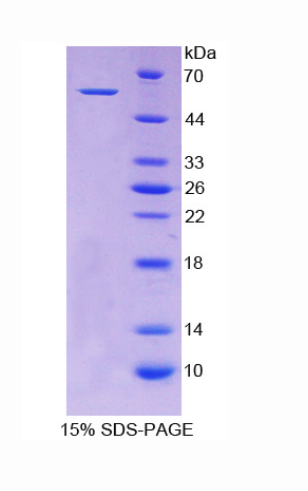 醛脱氢酶7家族成员A1(ALDH7A1)重组蛋白