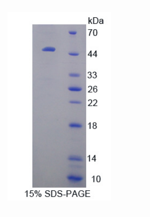 晶状体蛋白βB1(CRYbB1)重组蛋白