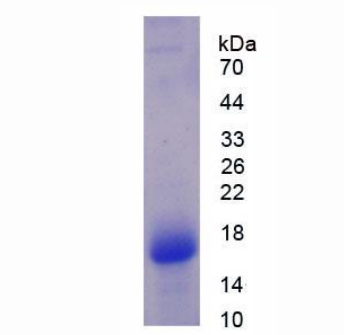 囊泡关联膜蛋白关联蛋白A(VAPA)重组蛋白