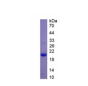 Ⅱ类主要组织相容性复合体DRα(HLA-DRA)重组蛋白