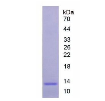 褪黑素受体1A(MTNR1A)重组蛋白
