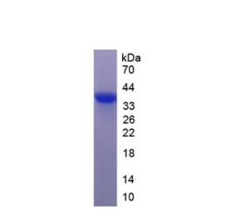 胰岛细胞自身抗原1(ICA1)重组蛋白