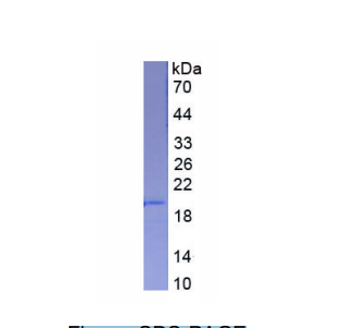 唾液酸结合Ig样凝集素5(SIGLEC5)重组蛋白
