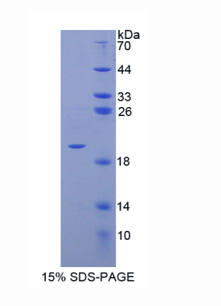 唾液酸结合Ig样凝集素9(SIGLEC9)重组蛋白