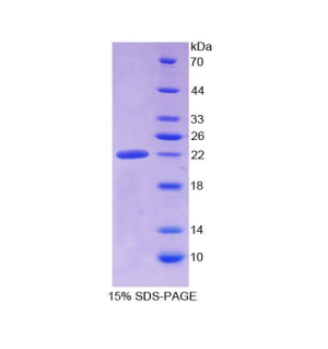 醛脱氢酶1家族成员A3(ALDH1A3)重组蛋白