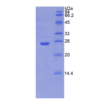嘌呤霉素敏感性氨肽酶(PSA)重组蛋白