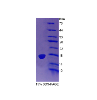 吲哚胺2,3-双加氧酶2(IDO2)重组蛋白