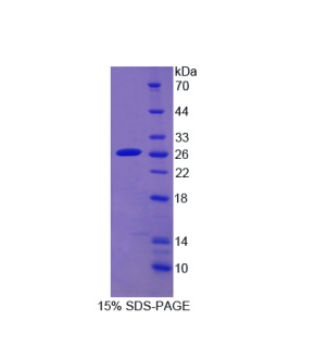 细胞色素P450家族成员2D6(CYP2D6)重组蛋白