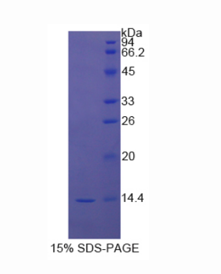 信号传导转录激活因子3(STAT3)重组蛋白