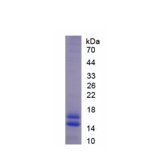 衰老关键蛋白5(FBLN5)重组蛋白