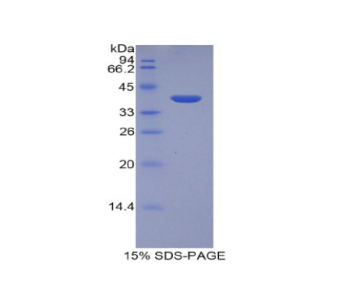肝表达抗菌肽2(LEAP2)重组蛋白