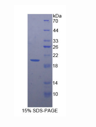 集落刺激因子2受体α(CSF2Ra)重组蛋白