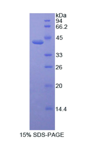 激活素A受体ⅡA(ACVR2A)重组蛋白