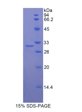 低密度脂蛋白受体相关蛋白关联蛋白1(LRPAP1)重组蛋白