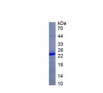角蛋白23(KRT23)重组蛋白