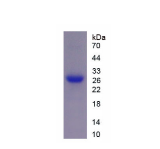 白介素2受体γ(IL2Rg)重组蛋白