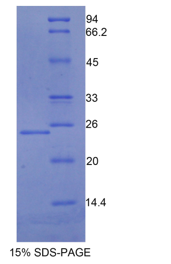 白介素13受体α1(IL13Ra1)重组蛋白