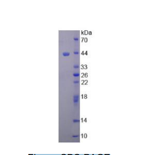 肌动蛋白γ1(ACTG)重组蛋白