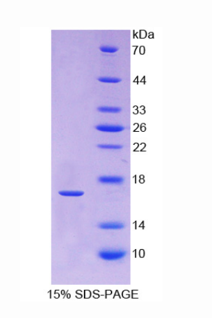 松弛素/胰岛素样肽受体1(RXFP1)重组蛋白