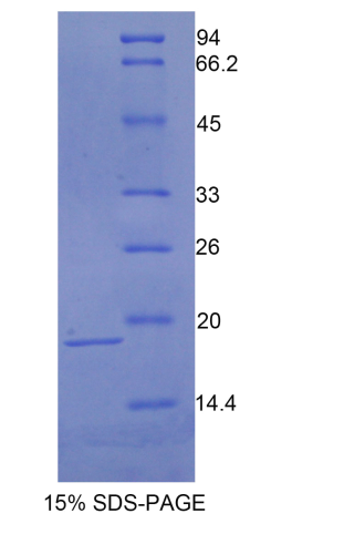 抑丝蛋白2(PFN2)重组蛋白