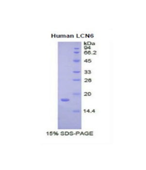 脂质运载蛋白6(LCN6)重组蛋白