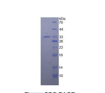 白介素1受体关联激酶2(IRAK2)重组蛋白