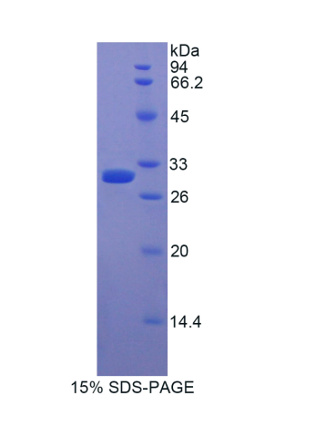 肌球蛋白ⅠE(MYO1E)重组蛋白