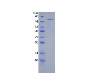 整合素β2(CD18)重组蛋白