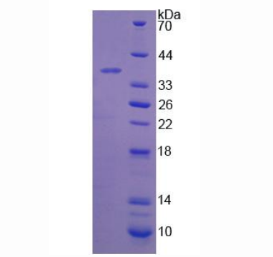 17-β-羟基类固醇脱氢酶12(HSD17b12)重组蛋白