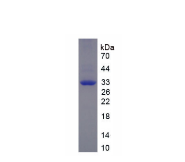 肌球蛋白重链3(MYH3)重组蛋白