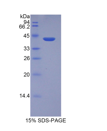 组蛋白2簇H2aa3(HIST2H2AA3)重组蛋白