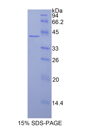 组蛋白3簇H2a(HIST3H2A)重组蛋白