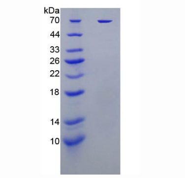 杀伤细胞免疫球蛋白样受体2DL1(KIR2DL1)重组蛋白