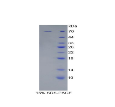 杀伤细胞免疫球蛋白样受体2DL2(KIR2DL2)重组蛋白