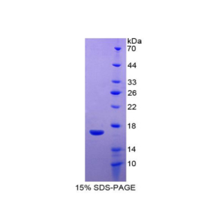 WAP四二硫化物核心域蛋白5(WFDC5)重组蛋白