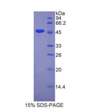 脂质运载蛋白4(LCN4)重组蛋白