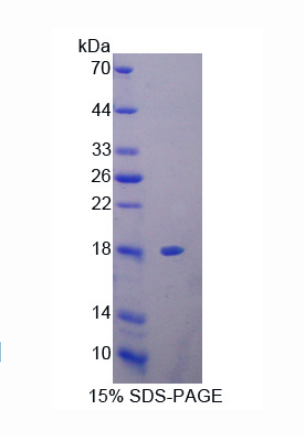 抑丝蛋白3(PFN3)重组蛋白