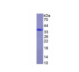 CD163分子(CD163)重组蛋白