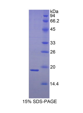 热休克蛋白β3(HSPb3)重组蛋白