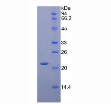 CD8b分子(CD8b)重组蛋白