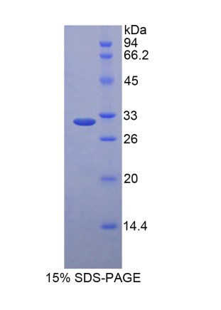 低密度脂蛋白受体相关蛋白5样蛋白(LRP5L)重组蛋白