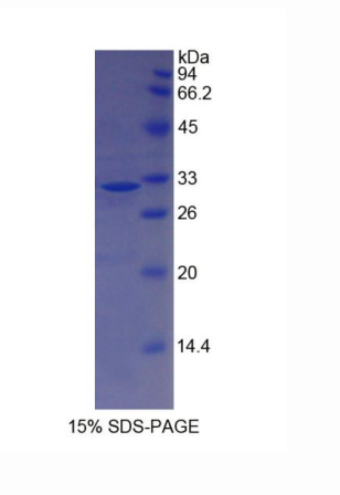 肌球蛋白重链14(MYH14)重组蛋白