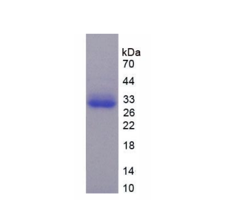 TNFRSF1A关联Via死亡域蛋白(TRADD)重组蛋白