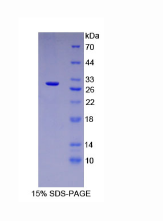 微管蛋白β6(TUBb6)重组蛋白