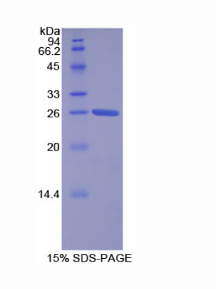 耐扭蛋白2A(TOR2A)重组蛋白