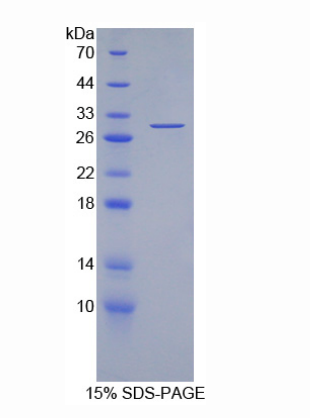 耐扭蛋白3A(TOR3A)重组蛋白