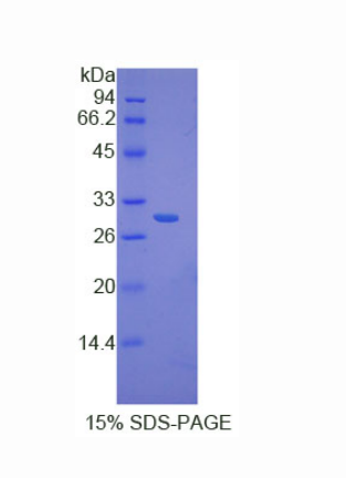 核因子κB抑制因子δ(IkBd)重组蛋白