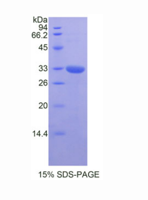 GRB2相关衔接蛋白2(GRAP2)重组蛋白