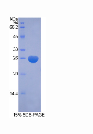 畸胎瘤衍生生长因子FRL1隐藏家族1(CFC1)重组蛋白