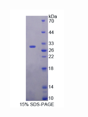 含DIX域蛋白1(DIXDC1)重组蛋白